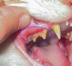 Tooth Decay and Toothache